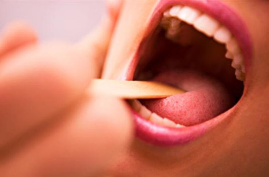 Τύποι παρασίτων στο ανθρώπινο στόμα